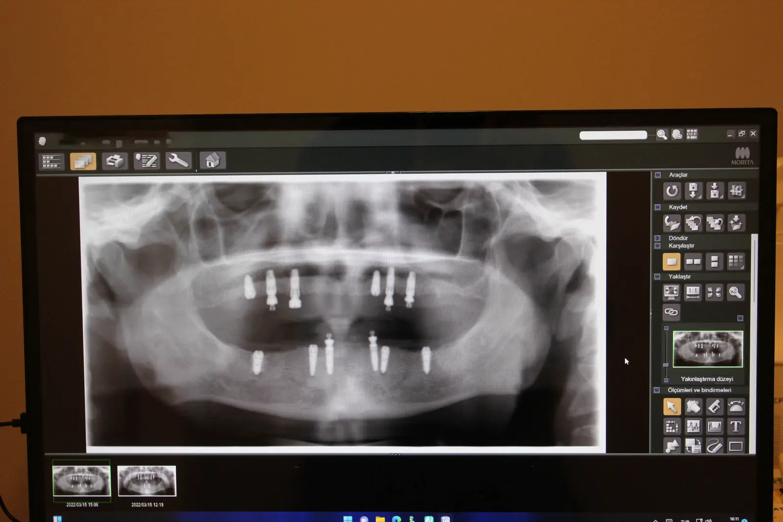 Özel İstanbul Diş Akademisi Ağız ve Diş Sağlığı Polikliniği