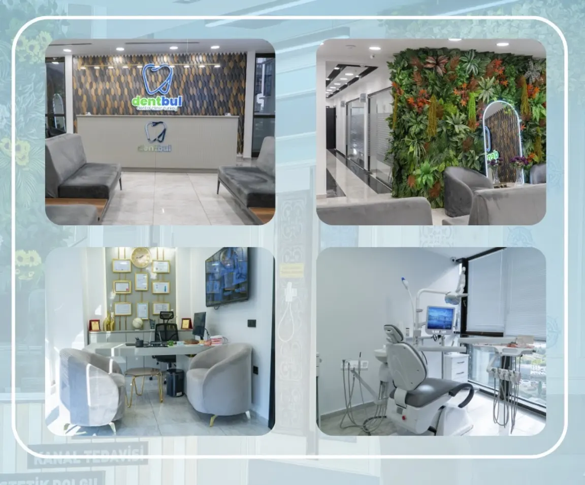 Dentbul Dental Clinic